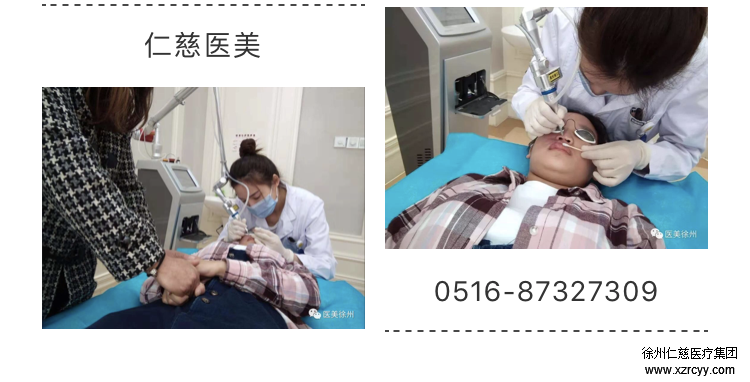 呂艷趁國(guó)慶假期，來(lái)我院接受激光手術(shù)治療