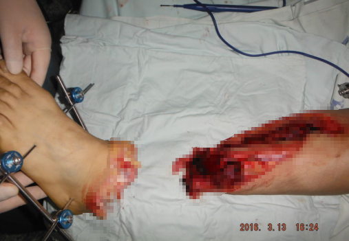 <a href='http://www.globaltechresearch.com/' target='_blank'><u>徐州仁慈醫(yī)院</u></a>