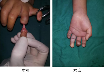 <a href='http://www.globaltechresearch.com/' target='_blank'><u>徐州仁慈醫(yī)院</u></a>手外科